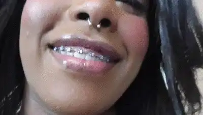 Femdom Austria - Black Girl Teeth Brace Fetish!