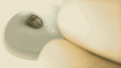 Soft Diarrhea
