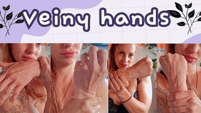 Veins of my hands
