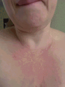 My shitburger